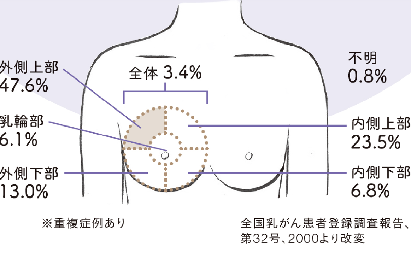 した 左 痛み 胸 の 急に胸が痛くなり続いています。心臓や肺の病気でしょうか？｜一般社団法人日本呼吸器学会