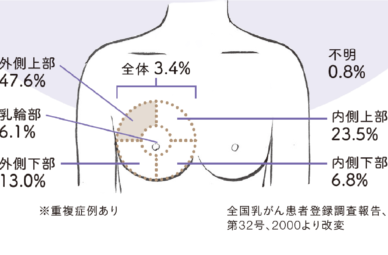 乳がん 時々おこる胸の痛みの原因は 胸痛危険度をチェック 頭痛 咳 微熱 腹痛 めまい 病院に行く前に読みたい 気になる不調 Mi Mollet ミモレ 明日の私へ 小さな一歩